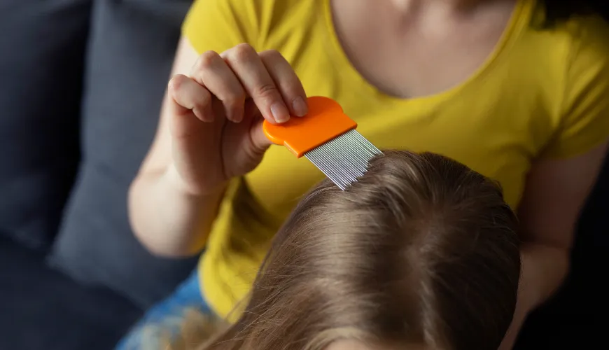 Természetes tippek és trükkök a tetvek megelőzésére